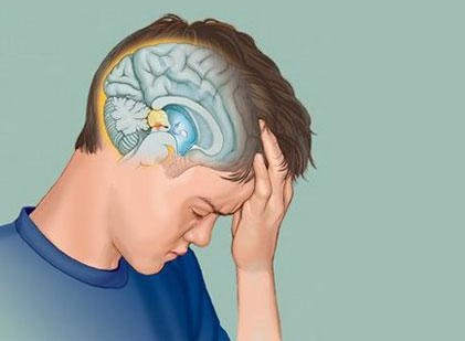 Киста шишковидной железы Киста шишковидной железы