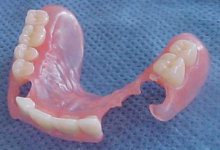 Нейлоновый протез фото 4 Нейлоновый протез фото 4